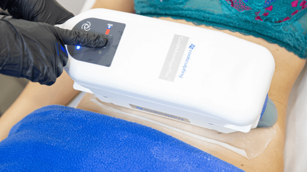 coolsculpting italia