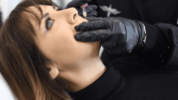 filler labbra naturali