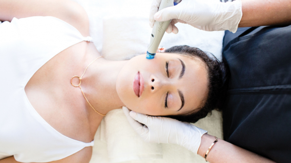 hydrafacial roma
