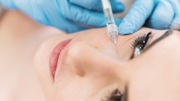 biorivitalizzazione viso