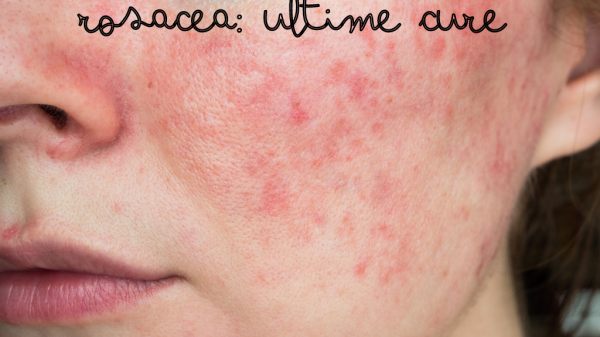 rosace ultime cure